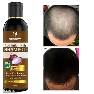 &nbsp;Onion Hair Shampoo For Dry Hair - Snihith Deep Nourishment Shampoo - Anti Hair Fall Hair Shampoo 100 ML-thumb0
