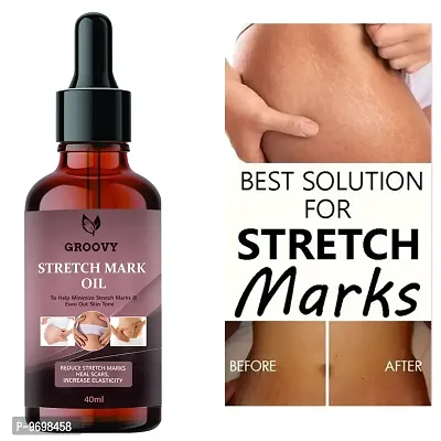 Stretch Marks Oil After Delivery Stretch Mark Removal Oil100% Organic 40Ml