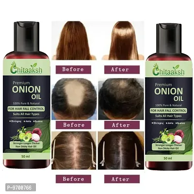 Onion Oil For Hair Regrowth and Hair Fall Control Hair Oil, Pack Of  Pack Of 2-thumb0