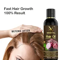 Hair Oil  Herbal Hair Oil Blend Of Natural Oils For Increase Hair Growth, Dandruff Control and To Stop Hair Fall&nbsp;Buy 1 Get 1 Free-thumb2
