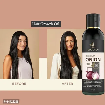 Red Onion Black Seed Hair Oil For Fast Hair Growth  ONION HAIR OIL (50ML) (PACK OF 1) Pack of 1-thumb0