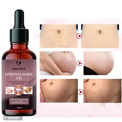Stretch Marks Oil Advance Natural Stretch Oil For Scars and Stretchmarks (40 Ml)-thumb0