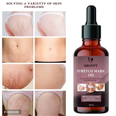 Stretch Marks Oil . Present Stretch Marks Removal Oil, Natural Heal Pregnancy,  ,  Legs,  Mark Oil 40Ml Ml Pack Of 1