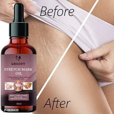 Stretch Marks Oil Organic Body Stretch Mark Removal Oil | Anti Aging | Pregnancy Stretch Mark Removal Oil| Scar Removal | Anti Wrinkle | Skin Hydration 40 Ml-thumb0