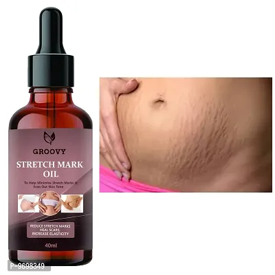 Stretch Marks Oil Present Repair Stretch Marks Removal, Natural Heal Pregnancy Breast,  Hip,  Legs,  Mark Oil 40 Ml Pack Of 1