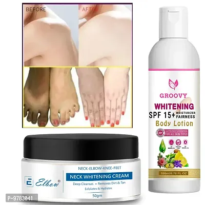 Body Lotion Spf15+ Skin Lighten and Brightening Cream Whitening Cream Shields Your Skin From Hurtful Uv Beams With Whitening Cream Pack Of 2-thumb0