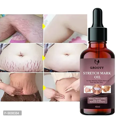Stretch Marks Oil  Therapy Oil For Stretch Marks,  Scars and Skin Toning, 40Ml With Argan Oil Pack Of 1-thumb0