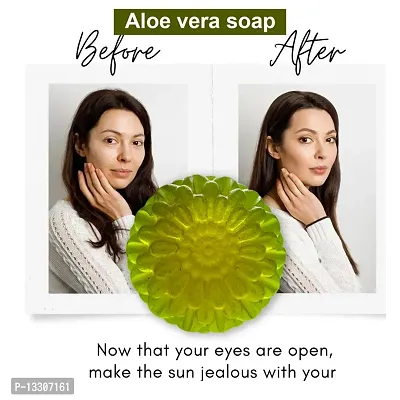 Nourishing Aloe Vera Soap For Gentle Cleansing And Rejuvenation -100 Grams-thumb0