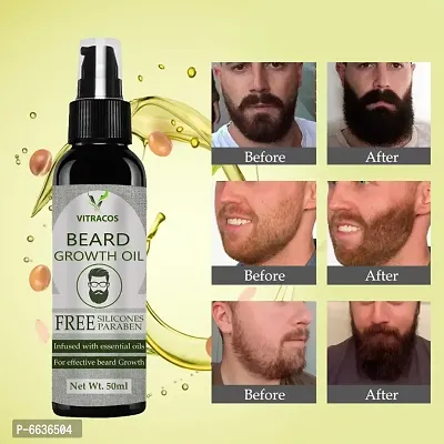 Advanced and Powerful Beard Growth oil andndash; For Faster Beard Growth and Patchy Beard With Redensy and 8 Natural Oils | Beard Oil | Beard Growth Oil | Dadhi Oil | Mooch Oil | Mustache Beard oil-thumb0