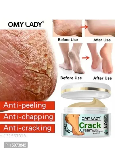Omy lady crack cream for foot crack