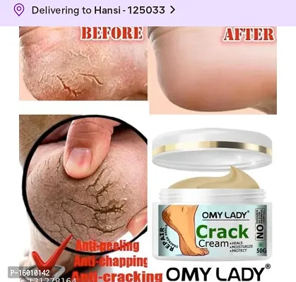 Omy lady crack cream for foot care-thumb0