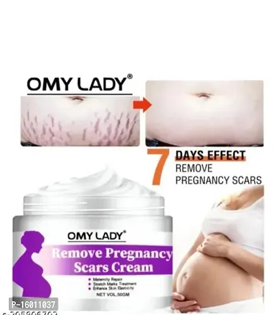 Omy lady Pargency mark remover cream