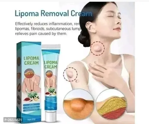 Lipoma cream