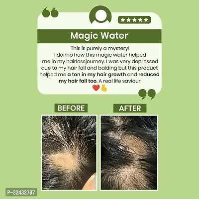 Frygen Rosemary Water For Hair Growth | Hair Spray for Regrowth | Rosemary Hair Mist 100ml pack of 1-thumb4