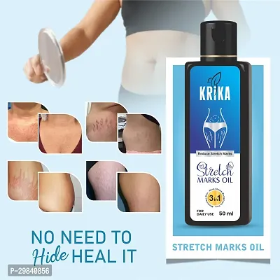 Stretch Marks Removal Oil