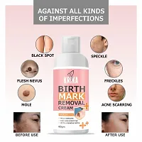 Krika Birthmark Removal Cream-thumb3