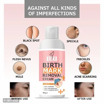 Krika Birthmark Removal Cream-thumb4