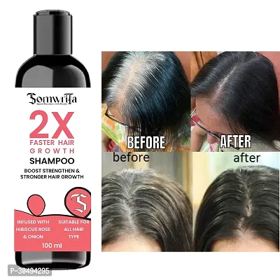 Faster Hair Growth With Hibiscus, Rose, And Onion For Strengthen and strong hair- 100ml-thumb4