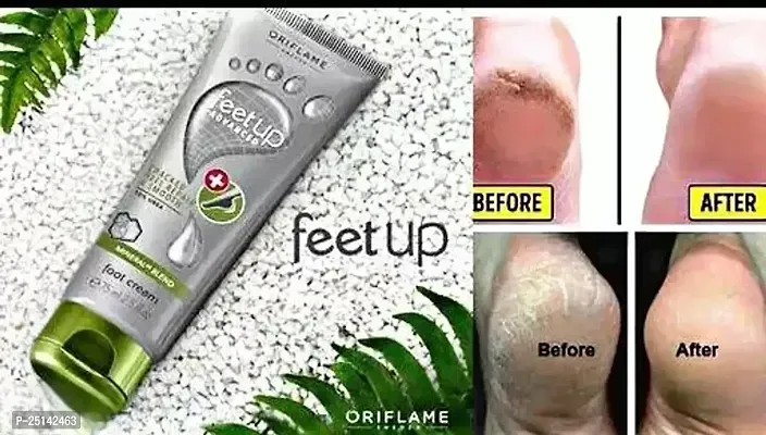 feetup advanced care foot cream for dryness and roughness of cracked heel