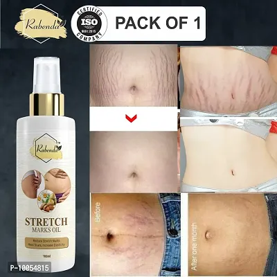present Repair Stretch Marks Removal - Natural Heal Pregnancy Breast, Hip, Legs, Mark oil 100 ml pack of 1-thumb0