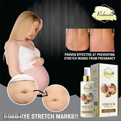 present Repair Stretch Marks Removal - Natural Heal Pregnancy Breast, Hip, Legs, Mark oil 100 ml pack of 2-thumb2