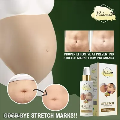 present Repair Stretch Marks Removal - Natural Heal Pregnancy Breast, Hip, Legs, Mark oil 100 ml pack of 2-thumb2