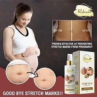 present Repair Stretch Marks Removal - Natural Heal Pregnancy Breast, Hip, Legs, Mark oil 100 ml pack of 2-thumb1