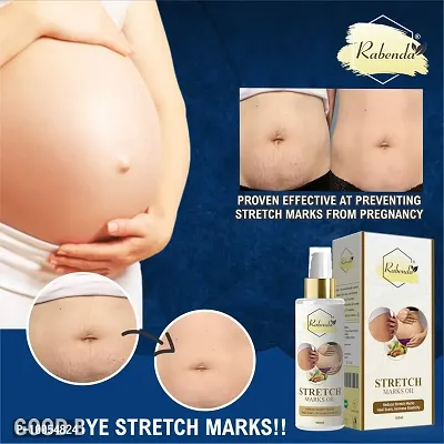 present Repair Stretch Marks Removal - Natural Heal Pregnancy Breast, Hip, Legs, Mark oil 100 ml pack of 2-thumb2