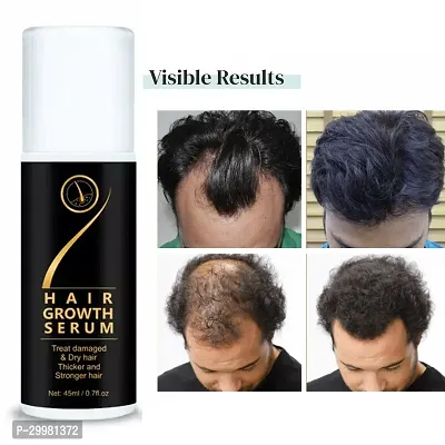 Hair Growth Serum For New Hair Growth Serum All Skin Type-thumb4