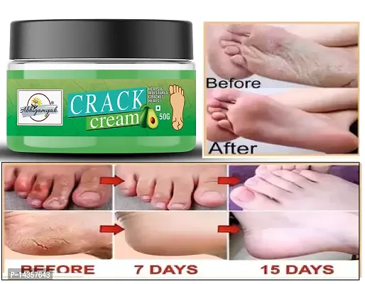 natural crack cream 50gm pc 1-thumb0