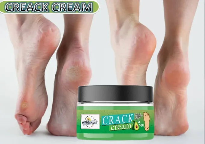 Abhigamyah Foot Care Cream