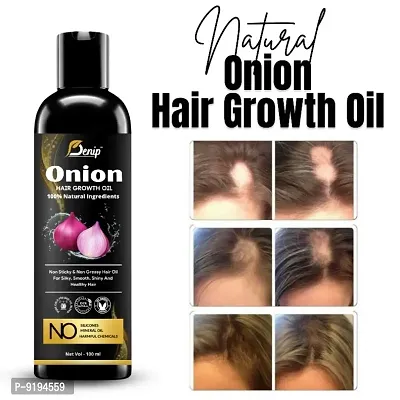 Denip Onio Hair Growth Oil