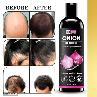 Natural Onion Hair Oil For Hair Damage Control and Hair Re Growth 100ML-thumb0