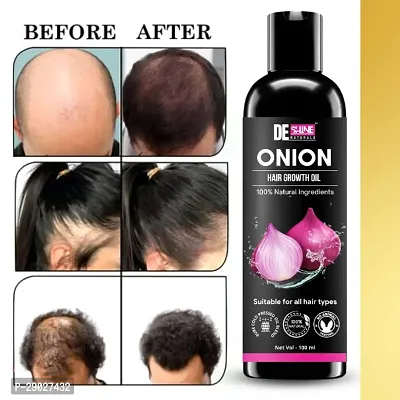 Onion Oil for Hair Growth and Regrowth | Black and Shiny Hair | Herbal Oil for Healthy Hair-thumb0