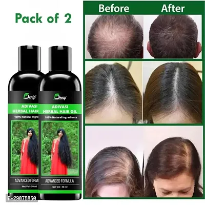 Adivasi Hair Oil | Ayurvedic Hair Oil | Anti Hair Fall and Hair Growth Oil | Adivasi Herbal Oil