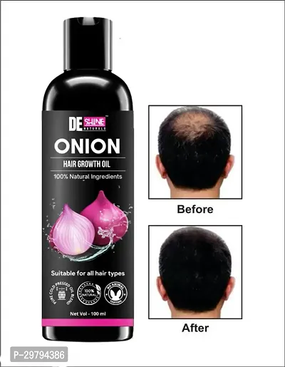 DE Shine Natural Onion Oil for Hair Growth and Hair Fall Control 100 ML-thumb0