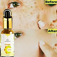 Vitamin C Serum - Skin Clearing Serum - Brightening, Anti-Aging Skin Repair, Supercharged Face Serum 50ml-thumb1