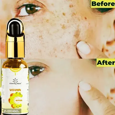 Vitamin C Serum - Skin Clearing Serum - Brightening, Anti-Aging Skin Repair, Supercharged Face Serum 50ml-thumb2