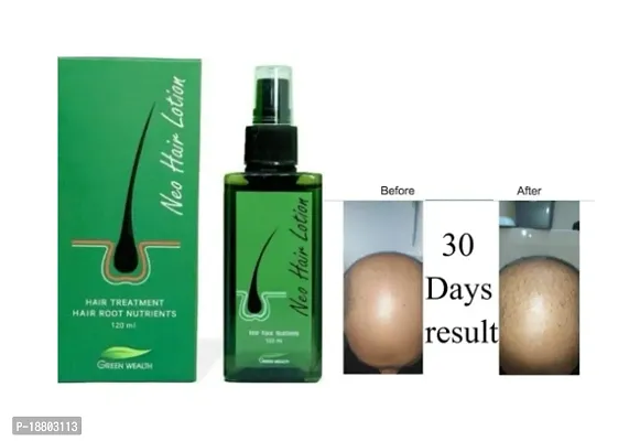 Original Neo Hair Lotion from Green Wealth Thailand 120 ML-thumb0