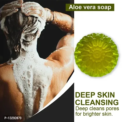 Soothing Aloe Vera Soap For Dry And Itchy Skin -100 Grams-thumb0