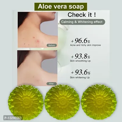 Aloe Vera Soap For Oily Skin-100 Grams Each, Pack Of 3-thumb0