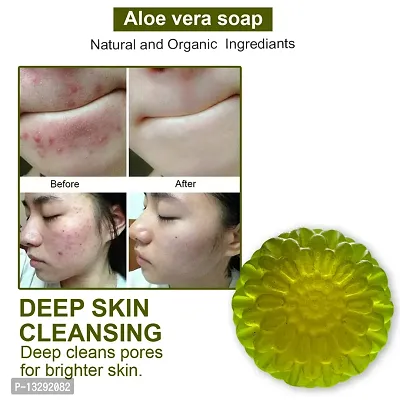 Organic Aloe Vera Soap For Chemical-Free Skincare -100 Grams-thumb0