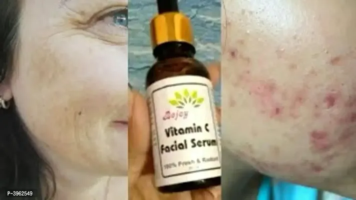 Bejoy Vitamin C Facial Serum 30Ml Skin Care Skin Serums-thumb3