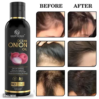 Ocean Onion Oil For Hair Fall Control, Hair Growth and Hair Regrowth-Control Dandruff - Pack Of 1-thumb0