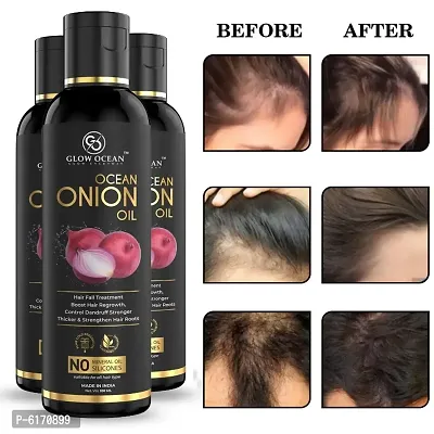 Ocean Onion Oil For Hair Fall Control, Hair Growth and Hair Regrowth-Control Dandruff - Pack Of 3