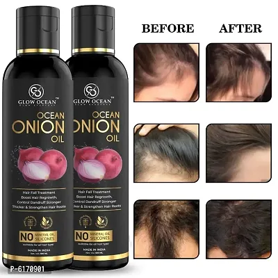 Ocean Onion Oil For Hair Fall Control, Hair Growth and Hair Regrowth-Control Dandruff - Pack Of 2