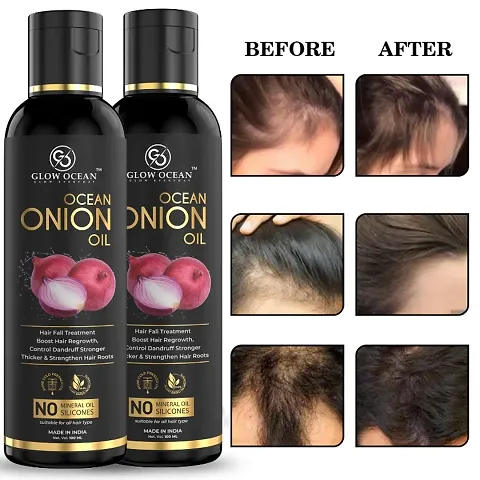 Ocean Onion Oil For Hair Fall Control, Hair Growth and Hair Regrowth