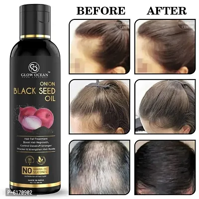 Ocean Onion Black Seed Oil For Hair Fall Control, Hair Growth and Hair Regrowth-Control Dandruff - Pack Of 1-thumb0