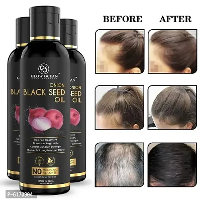 Ocean Onion Black Seed Oil For Hair Fall Control, Hair Growth and Hair Regrowth-Control Dandruff - Pack Of 3