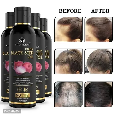 Ocean Onion Black Seed Oil For Hair Fall Control, Hair Growth and Hair Regrowth-Control Dandruff - Pack Of 4
